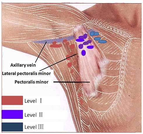 Drawing showing axillary lymph nodes